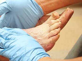 Diabetic Foot Care treatment in the Wayne County, MI: Detroit (Hamtramck, River Rouge, Dearborn, Melvindale, Highland Park, Grosse Pointe Park, Grosse Pointe, Lincoln Park, Allen Park, Redford Charter Twp) and Lucas County, OH: Toledo (Ottawa Hills, Silica, Holland, Shoreland, Oregon, Harbor View, Maumee) and Wood County, OH: Rossford, Northwood, Walbridge areas
