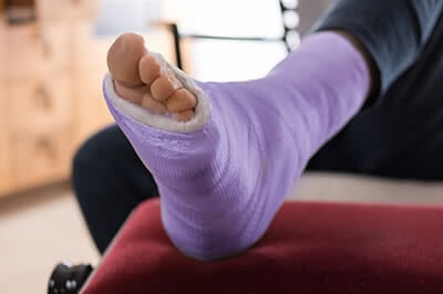 Foot and ankle Fractures treatment in the Wayne County, MI: Detroit (Hamtramck, River Rouge, Dearborn, Melvindale, Highland Park, Grosse Pointe Park, Grosse Pointe, Lincoln Park, Allen Park, Redford Charter Twp) and Lucas County, OH: Toledo (Ottawa Hills, Silica, Holland, Shoreland, Oregon, Harbor View, Maumee) and Wood County, OH: Rossford, Northwood, Walbridge areas