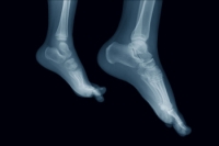 The Structure and Function of the Foot and Ankle