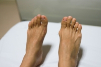 Bunions and Simple Exercises for Relief