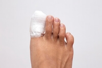 Managing Toe Fractures