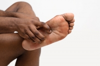 Erythromelalgia's Impact on the Feet